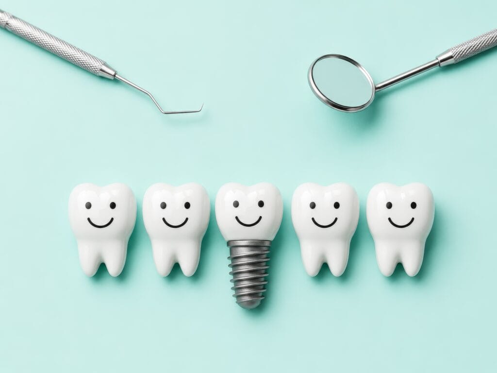 Five smiling tooth models arranged in a row on a mint green background, with a dental implant replacing the center tooth and dental tools positioned above.